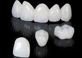 https://www.drmahabubsdentalcare.com/wp-content/uploads/2021/10/Zirconium_Crown.jpg